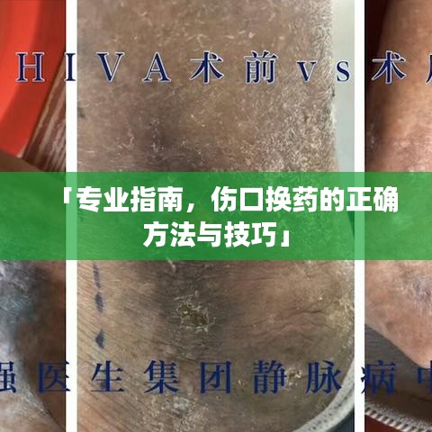 「专业指南,伤口换药的正确方法与技巧」