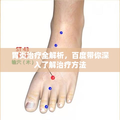 胃炎治疗全解析，百度带你深入了解治疗方法