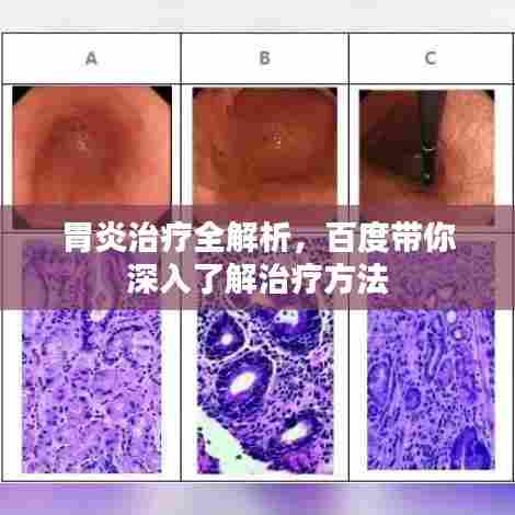 胃炎治疗全解析,百度带你深入了解治疗方法